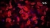 Un espoir face à la drépanocytose