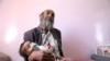 A man holds his malnourished daughter at a malnutrition treatment ward of al-Sabeen hospital in Sanaa, Yemen, Oct. 27, 2020. 
