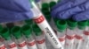 Un tube à essai étiqueté « virus mpox positif » est présenté dans cette illustration prise le 20 août 2024. (Reuters/Dado Ruvic/Illustration/Archives)