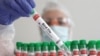 FILE - A person holds a test tube labeled "Bird Flu," in this illustration photo, Jan. 14, 2023. 