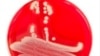 Researchers say anti-bacterial protein, PlyC could be effective antibiotic alternative