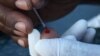 Study: Homosexual Community at Increased Risk for HIV