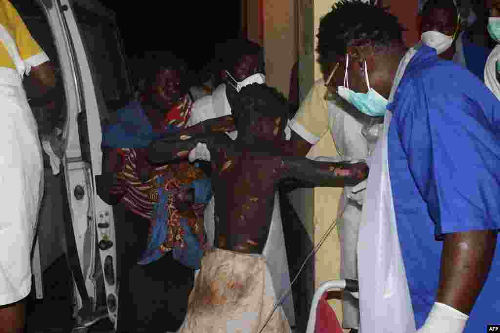 A badly burned child arrives at the Provincial Hospital in Tete, Mozambique, Nov. 17, 2016, after a truck carrying petrol burst into flames.