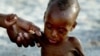 FILE - A mother holds on to her emaciated infant at an emergency feeding clinic in Maradi, Niger.