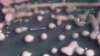 In this undated photo provided by the Centers for Disease Control and Prevention is one form of CRE bacteria, sometimes called “nightmare bacteria.” 