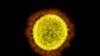 FILE - This 2020 electron microscope image made available by the National Institute of Allergy and Infectious Diseases shows a Novel Coronavirus SARS-CoV-2 particle isolated from a patient, in a laboratory in Fort Detrick, Md. (NIAID/NIH via AP, File)