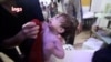 Mtoto akilia kufuatia kile kilichoripotiwa kama shabulizi la kutumia gesi ya sumu nchini Syria.