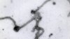 Ebola virus viewed through an electron microscope. The World Health Organization on Friday, Aug. 8, 2014 declared the Ebola outbreak in West Africa.