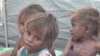 UN Official Warns of Imminent Great Hunger in Yemen