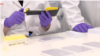 Medicamento antiviral español podría ser la cura del COVID-19, afirman científicos