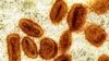 (Archives) Micrographie électronique à transmission colorisée de particules du virus mpox (avec enveloppe virale orange) trouvées dans une cellule infectée (verte). (Image fournie, via AP, par le National Institute of Allergy and Infectious Diseases en 2024)