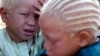 FILE - Albino twins beg for money at the entrance to the main mosque in Senegal's second city of Touba, March 29, 2005. 